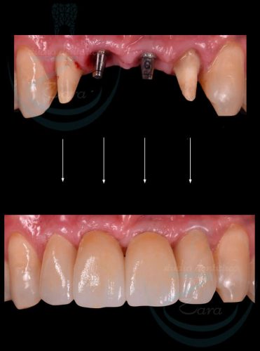 Case-study-impianto-dentale