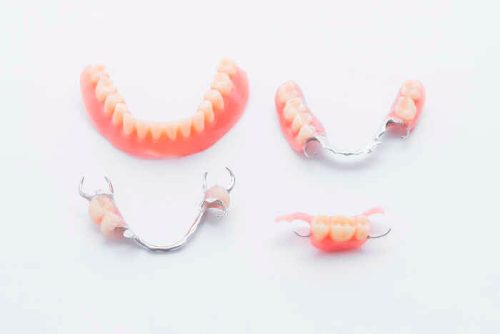esempi-dentiera