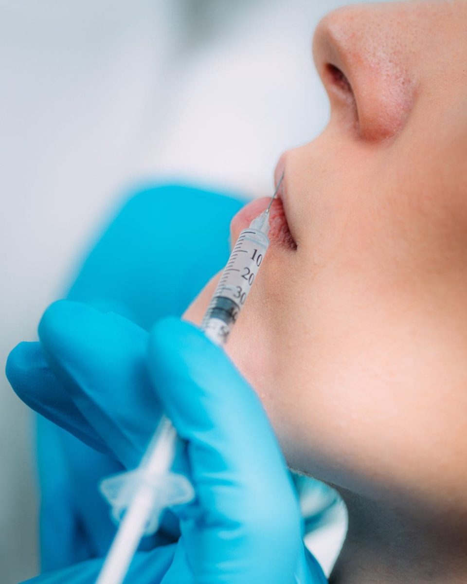 filler labbra Studio dentistico Zara Sassari