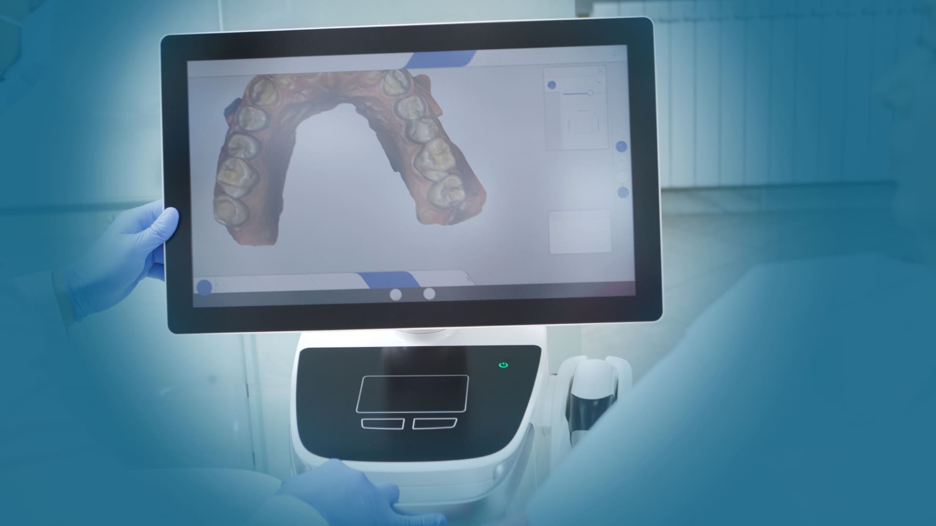 Impronta dentale digitale