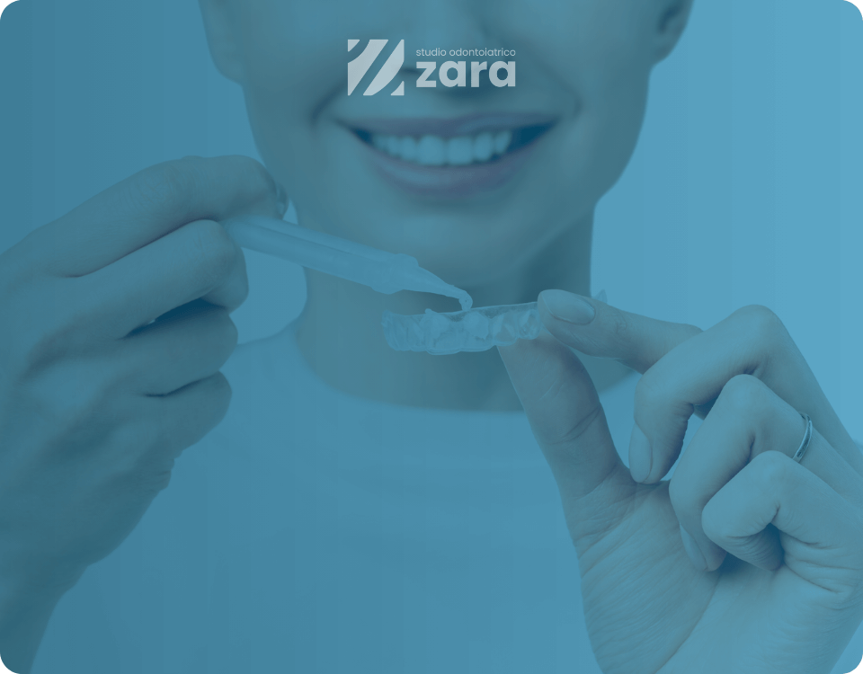 Il perossido di carbamide per sbiancare i denti